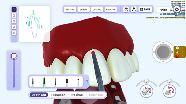 牙医模拟器最新版图3
